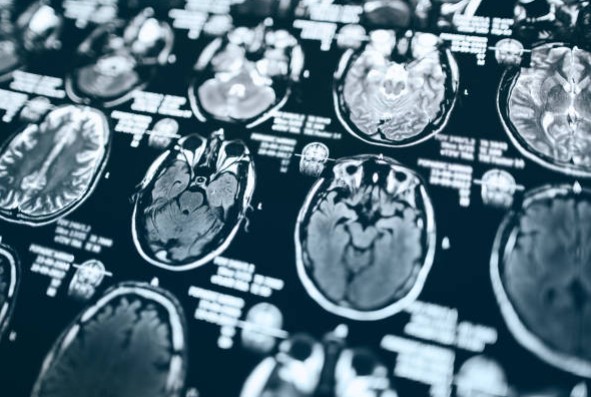 Imagen de tecnología médica